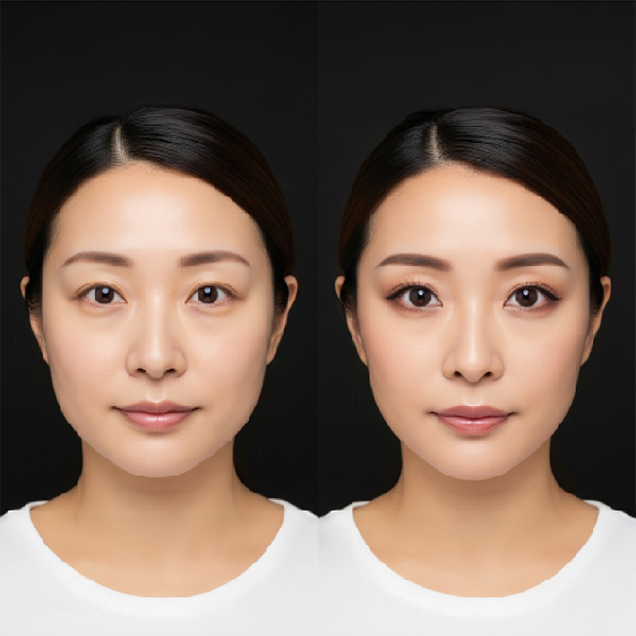 1フルフェイスデザインで洗練された美しさへ － 顔全体のバランスを整える総合施術